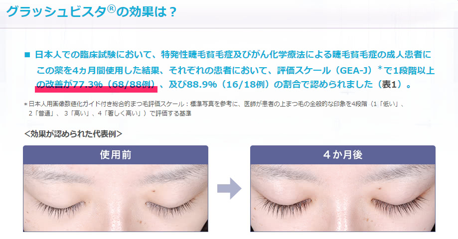 グラッシュビスタ(ビマトプロスト)は4ヶ月で77%に効果がある