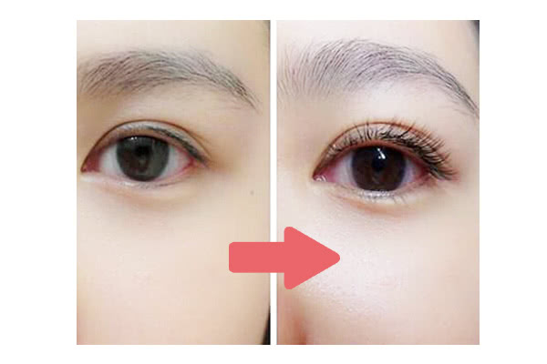 モデラッシュの使用前後の写真(目を開けた状態)